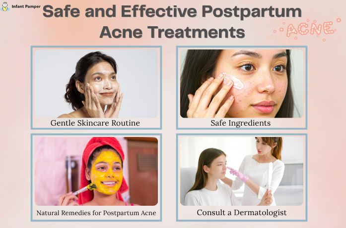 Safe and Effective Postpartum Acne Treatments